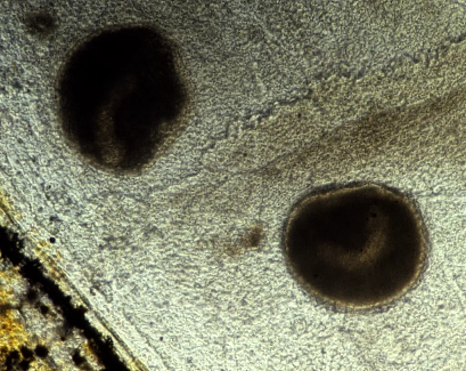 Trophonts of Ichthyophthirius multifiliis in fish tissue